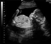 Пятый месяц беременности, развитие плода и ощущения матери Большой ли живот на 5 месяце беременности